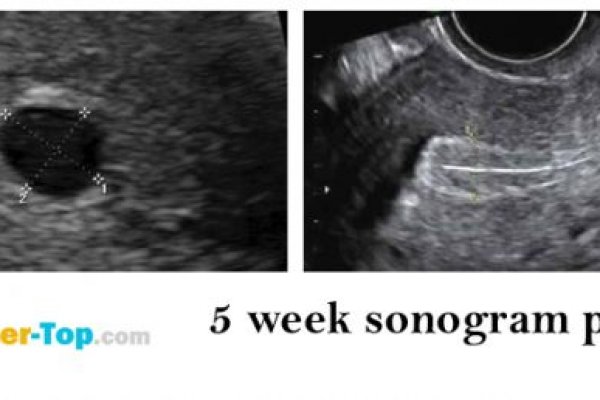 Зайти кракен через тор